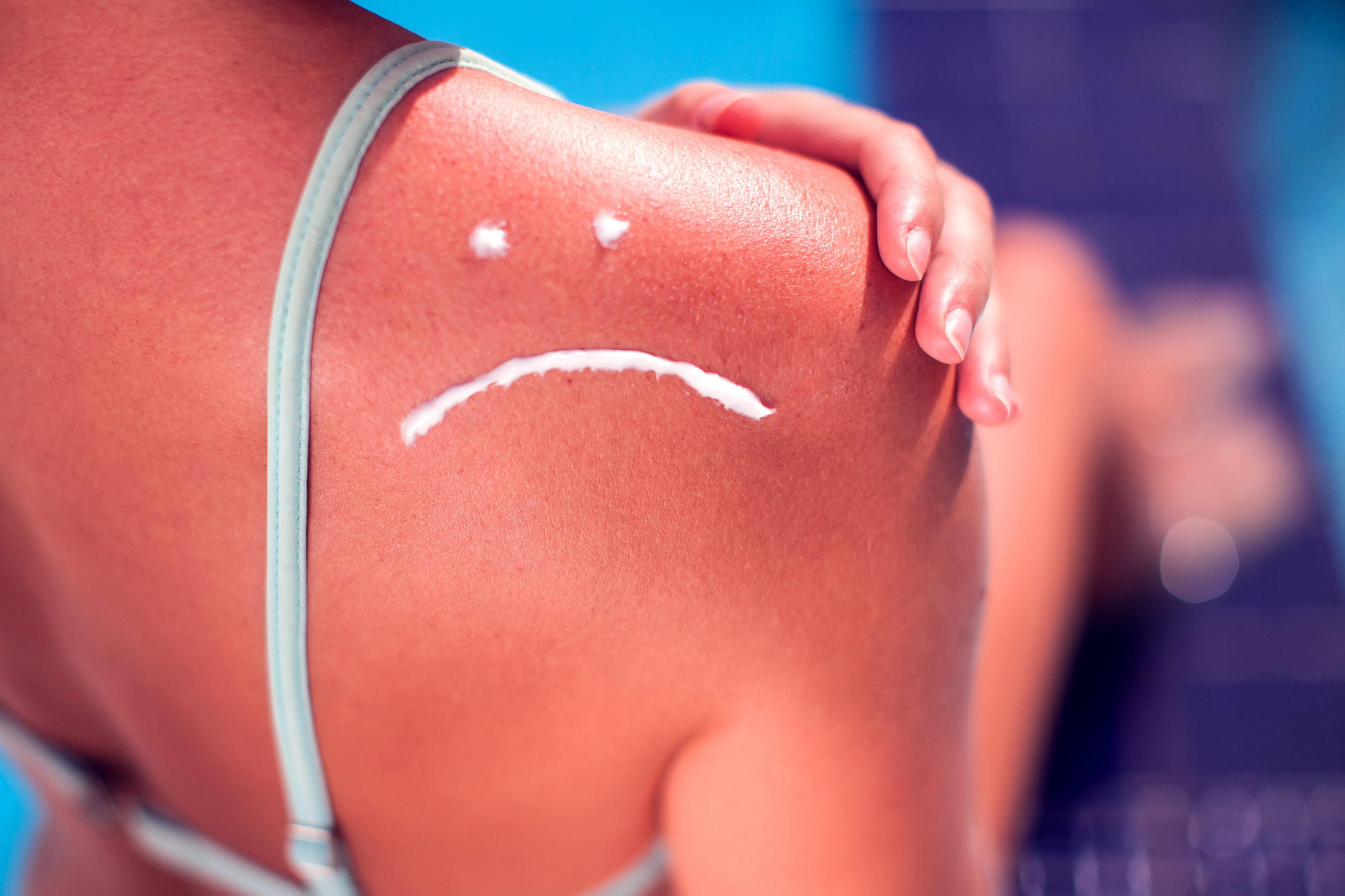 Les bons gestes à appliquer pour protéger votre peau du soleil